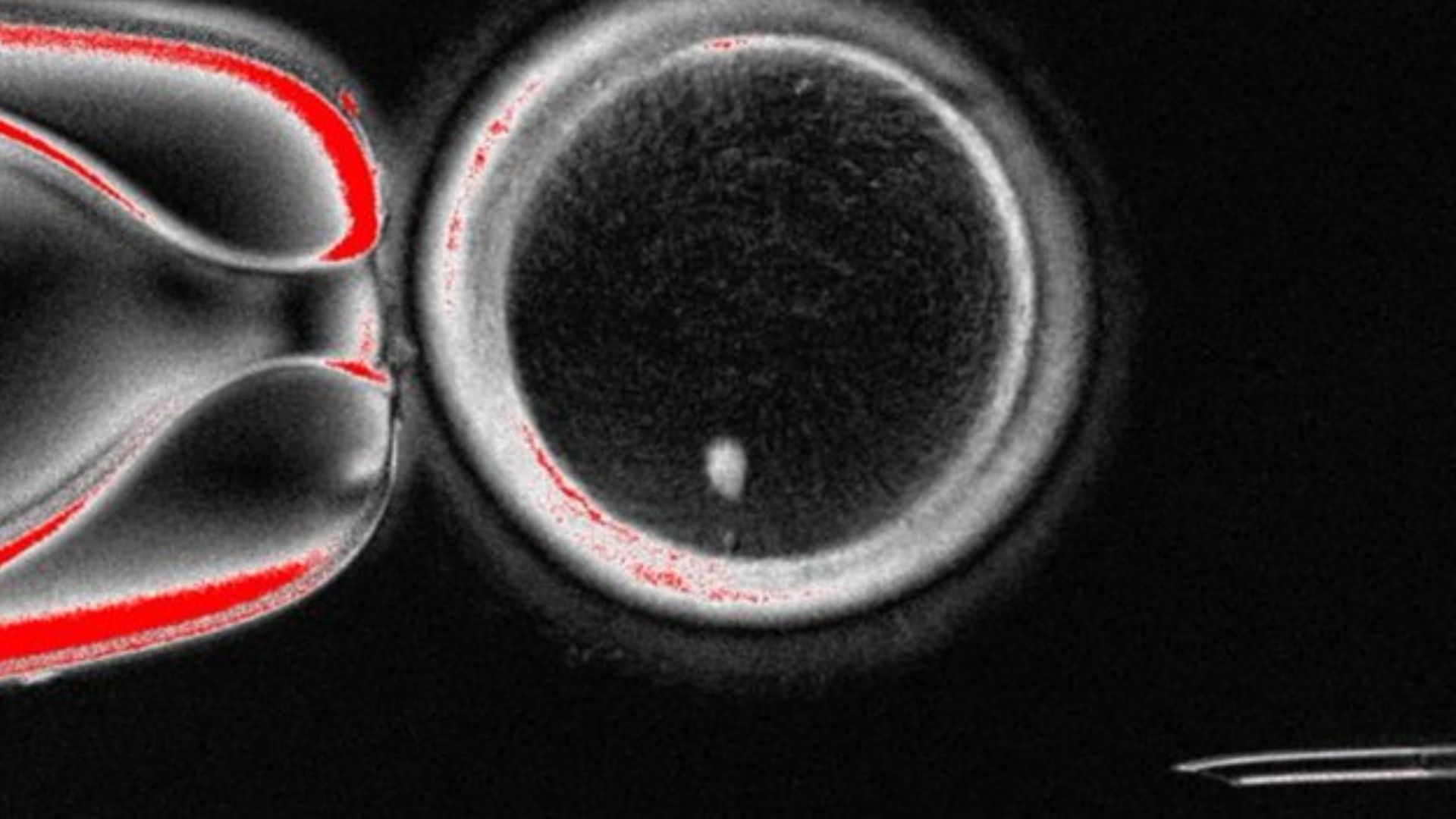 Human Eggs Created from Skin Cells, Scientists Say ‘It’s Possible’